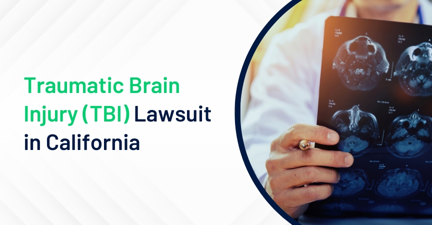 Traumatic Brain Injury (TBI) Lawsuit in California